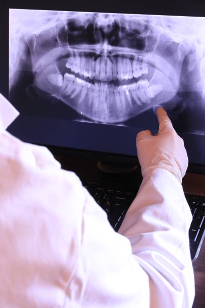 Best Knocked-Out Tooth (Avulsed Tooth) Treatment in La Crescent, MN