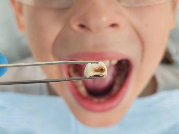 Best Emergency Pediatric Dental Care in La Crescent, MN
